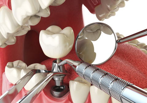 dental