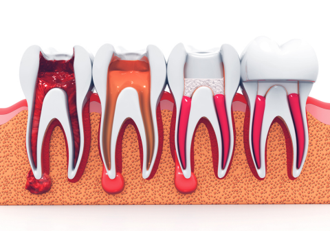 dental