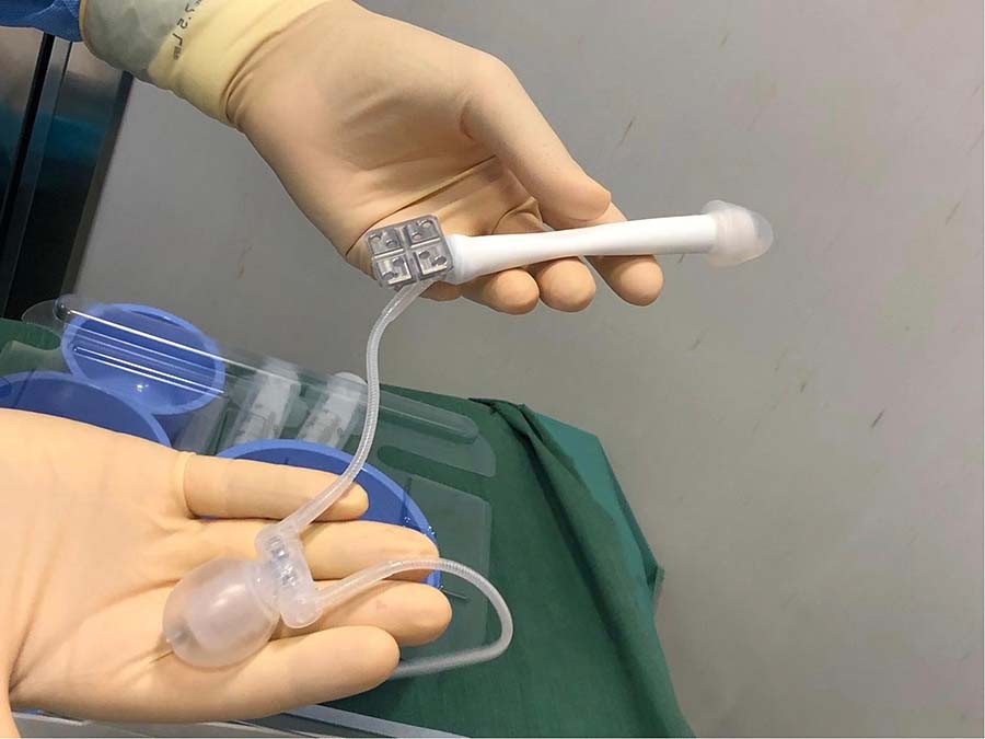 phalloplasty
